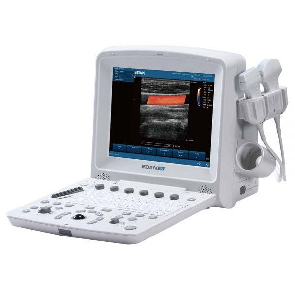Solic U50 Ultrasound System