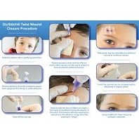 GluStitch® 0.2mL, Violet