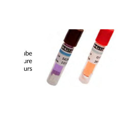 Delta steam biological indicator